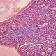 Illustration for article titled Ecuadorian Genetic Mutants Are Immune to Cancer